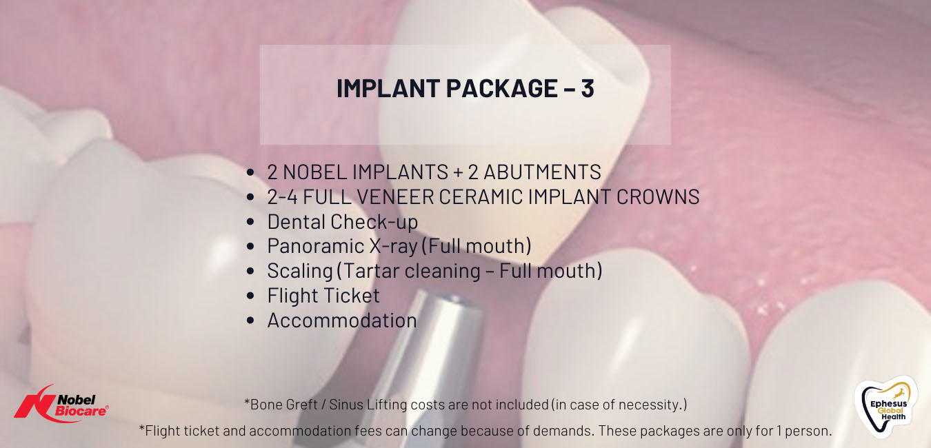 Implant (4) kopya