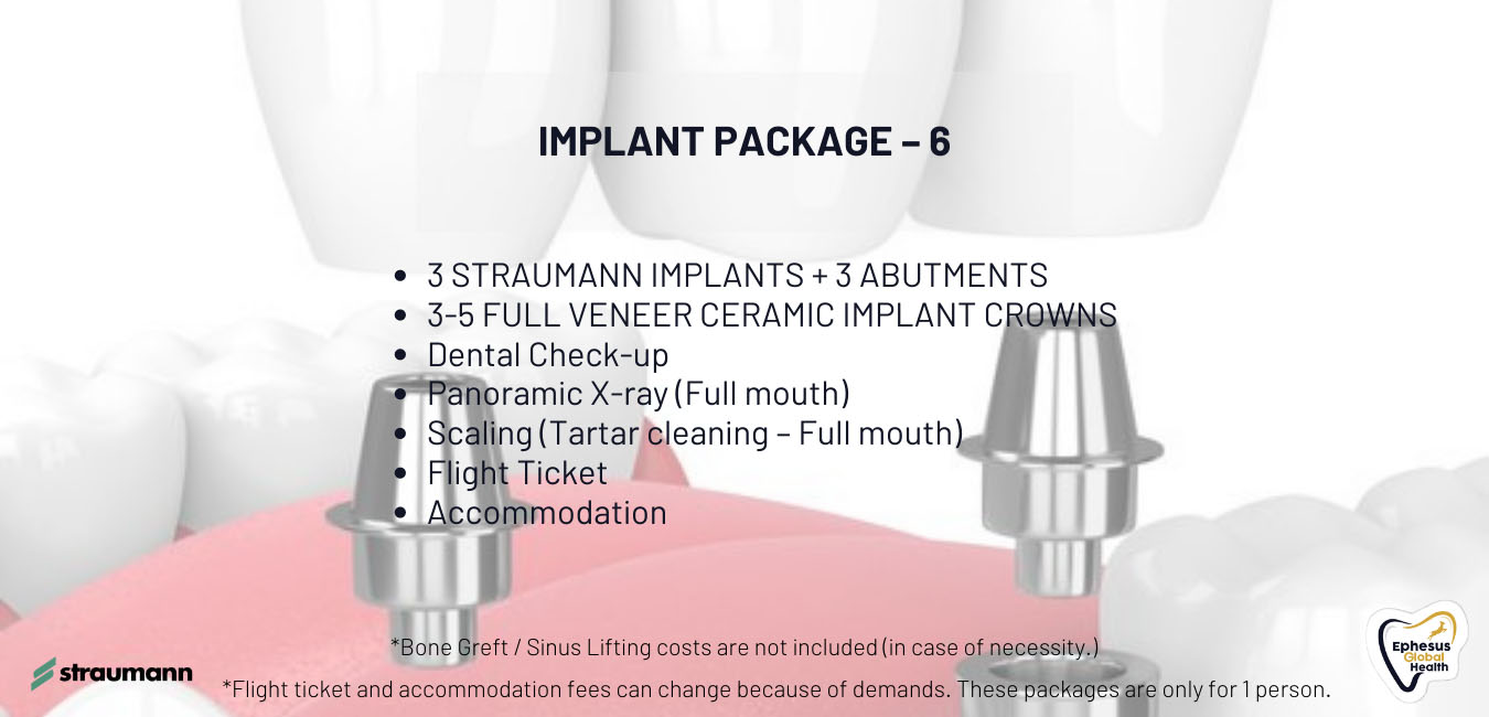 Implant (7) kopya